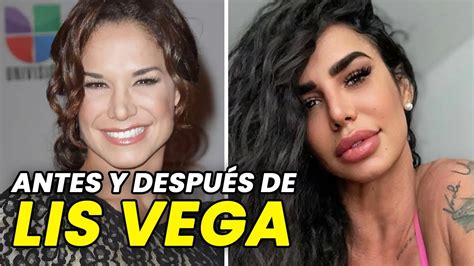 ANTES Y DESPUÉS DE LIS VEGA. Así es como ha cambiado la。